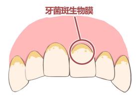 牙斑菌