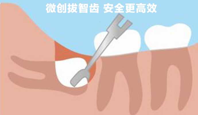 1-211106152410B9.png