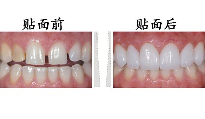 1-21111314434GR.jpg